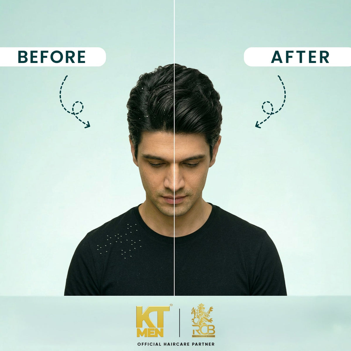 Flake Free Scalp | Zinc PCA 