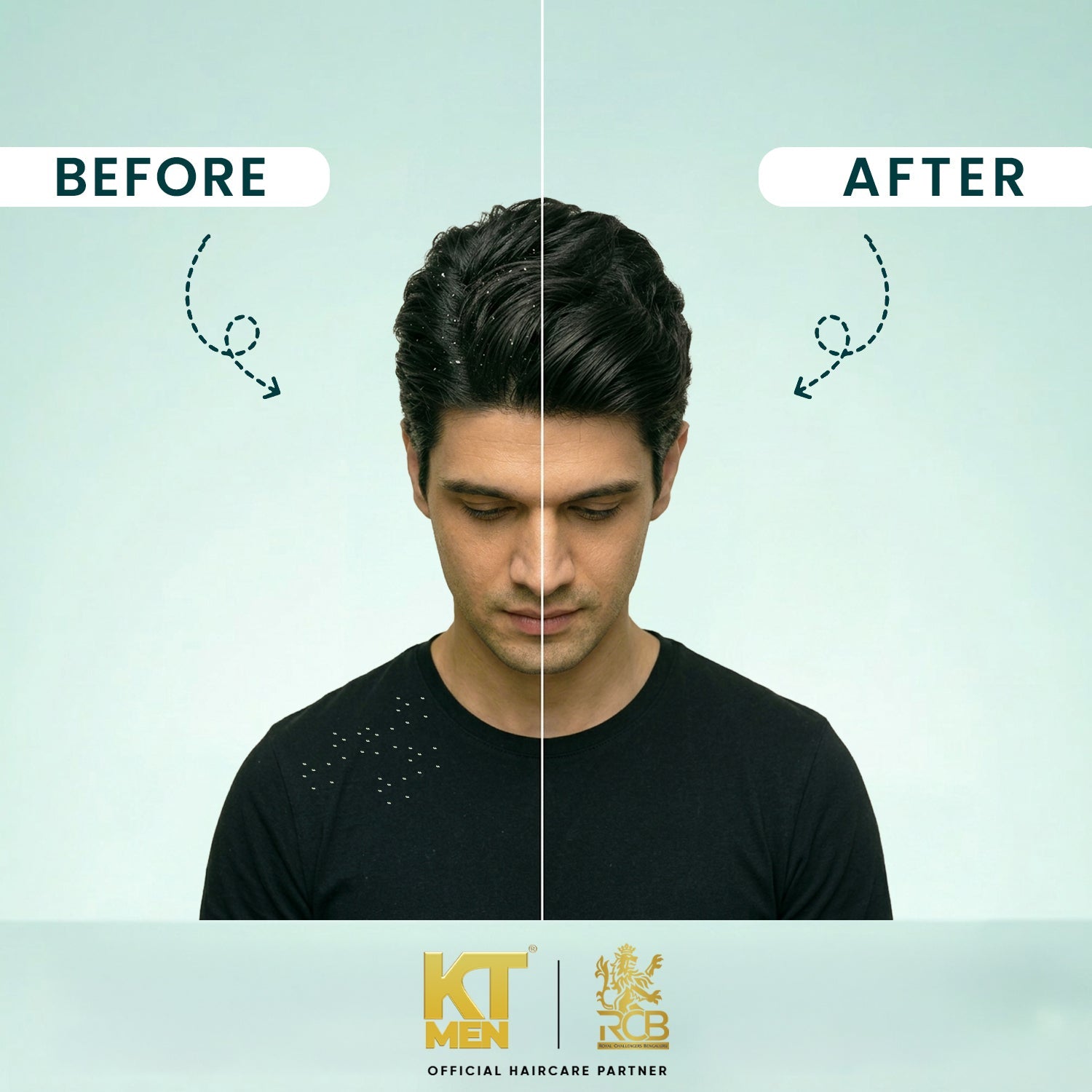 Flake Free Scalp | Zinc PCA 