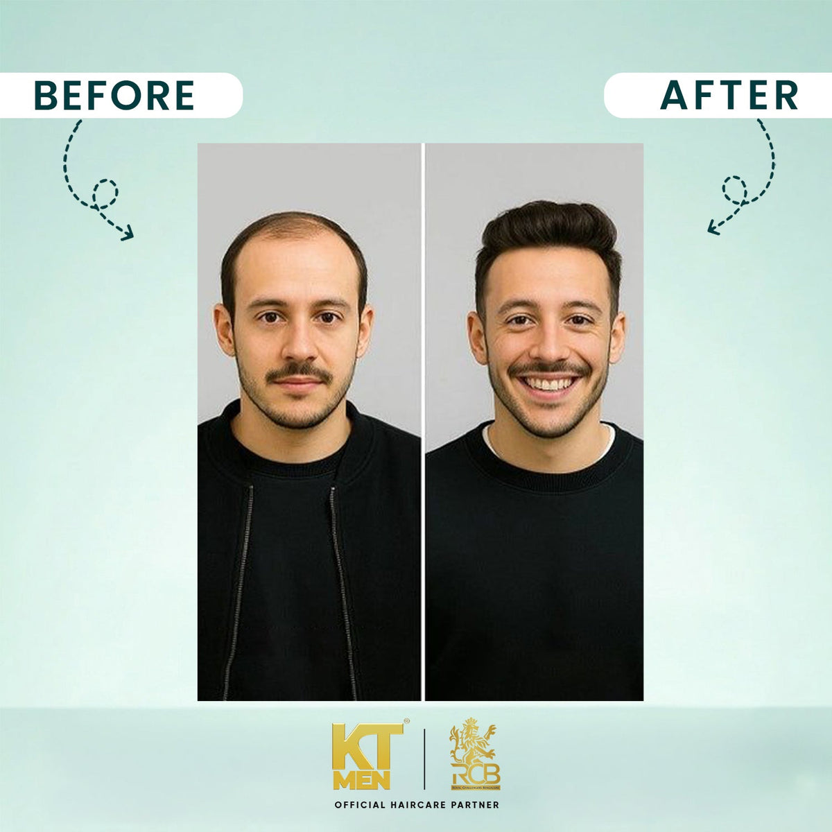 2in1 Hair Max Growth Oil - All Hair Serum (Hair + Beard) - 120 ml