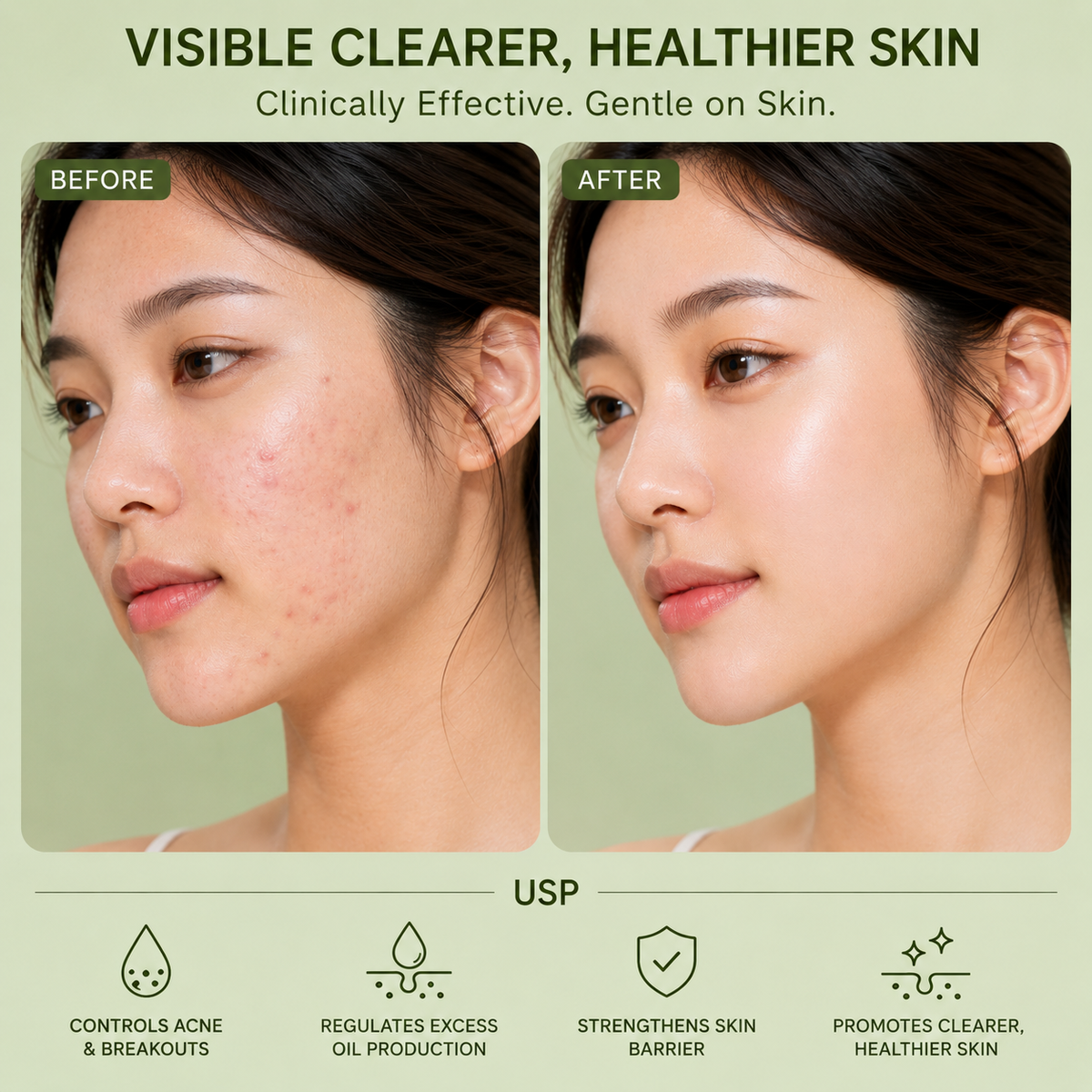 KT DERMA Acne Reset Serum