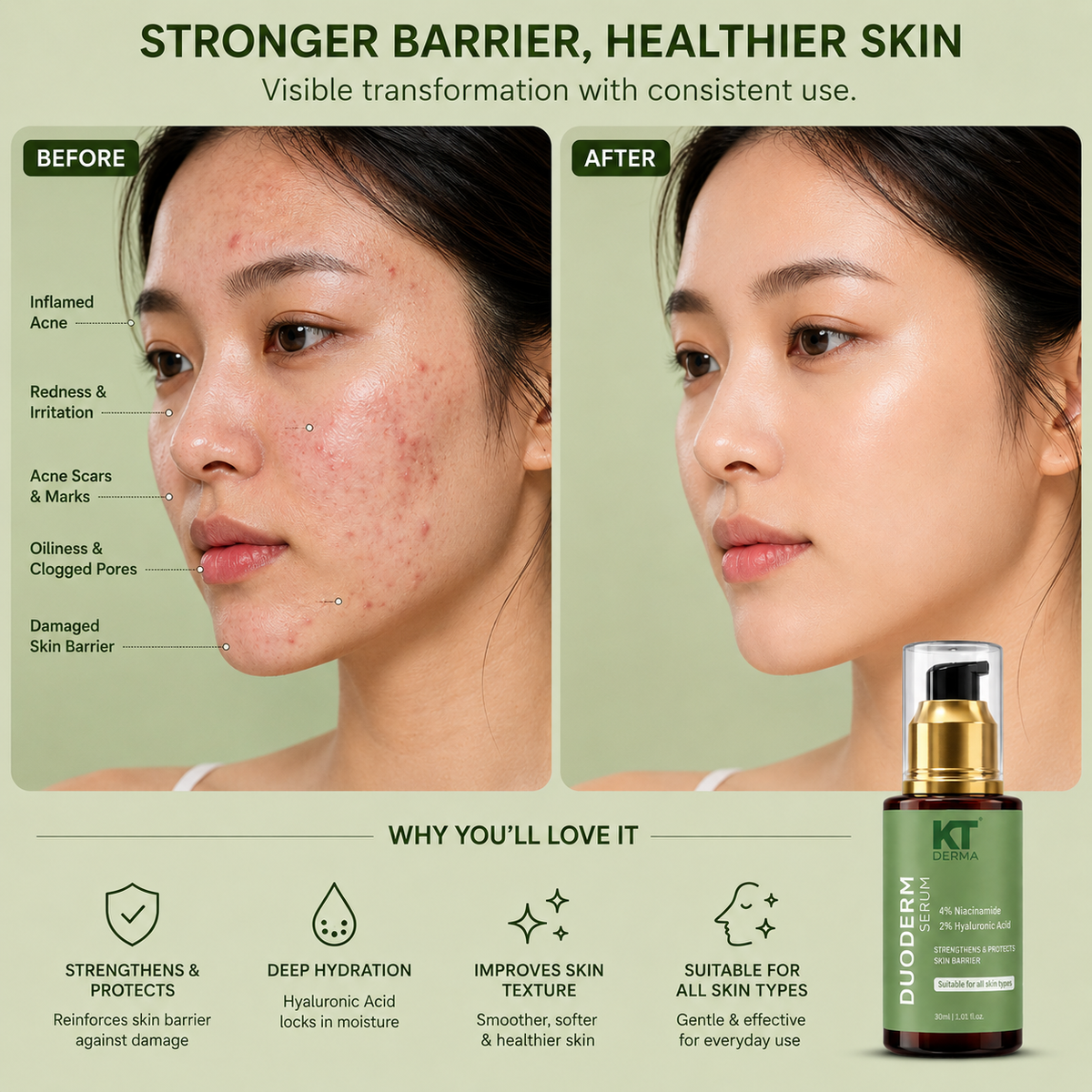 KT DERMA Duoderm Hydra Barrier Serum