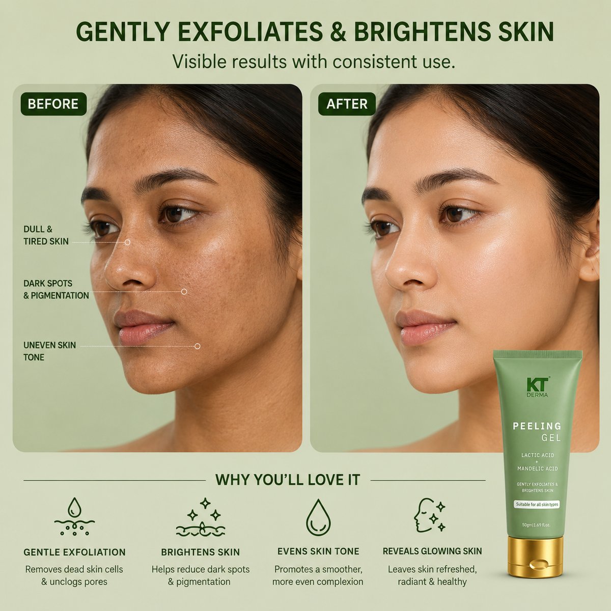 Milk Peel Gel