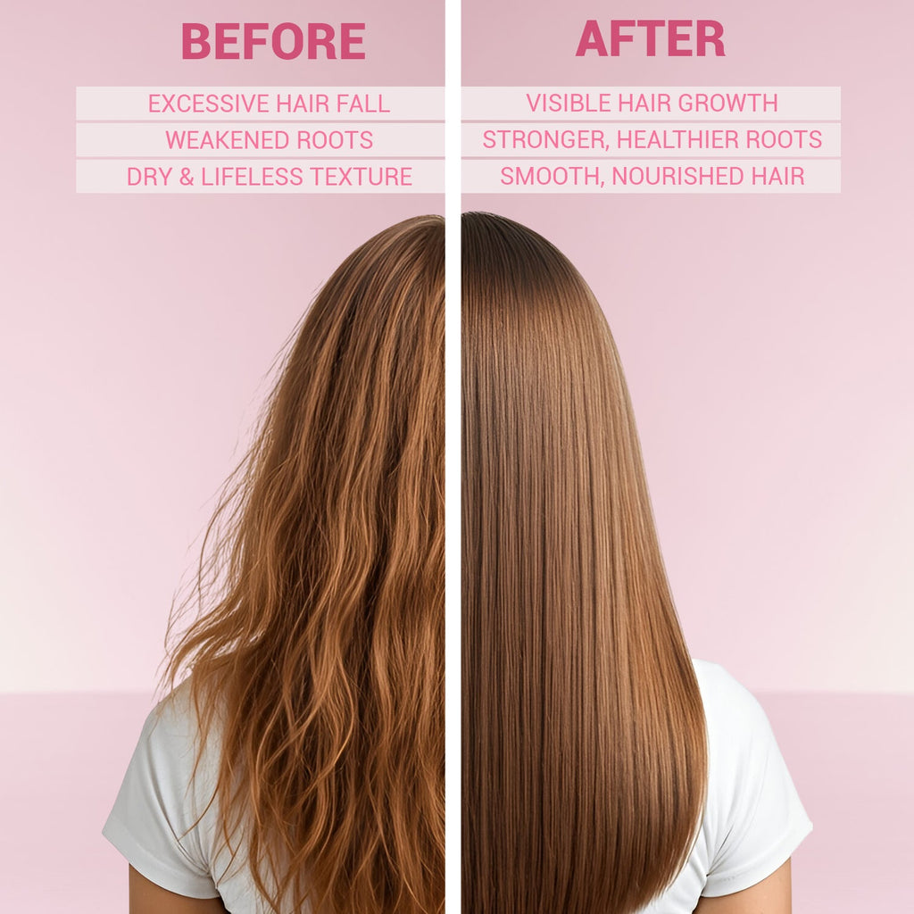 Organic Onion Hair Serum | Hair Fall Control  & Growth | Leave-In